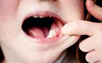 不同体质对症食疗治磨牙